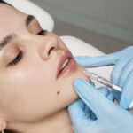 close-up-woman-getting-lip-fillers